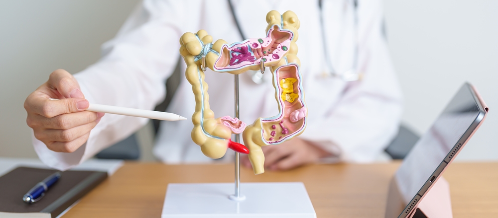 대장암 환자, 무리해서 ‘복강경 수술’하면 합병증 위험 2배 증가