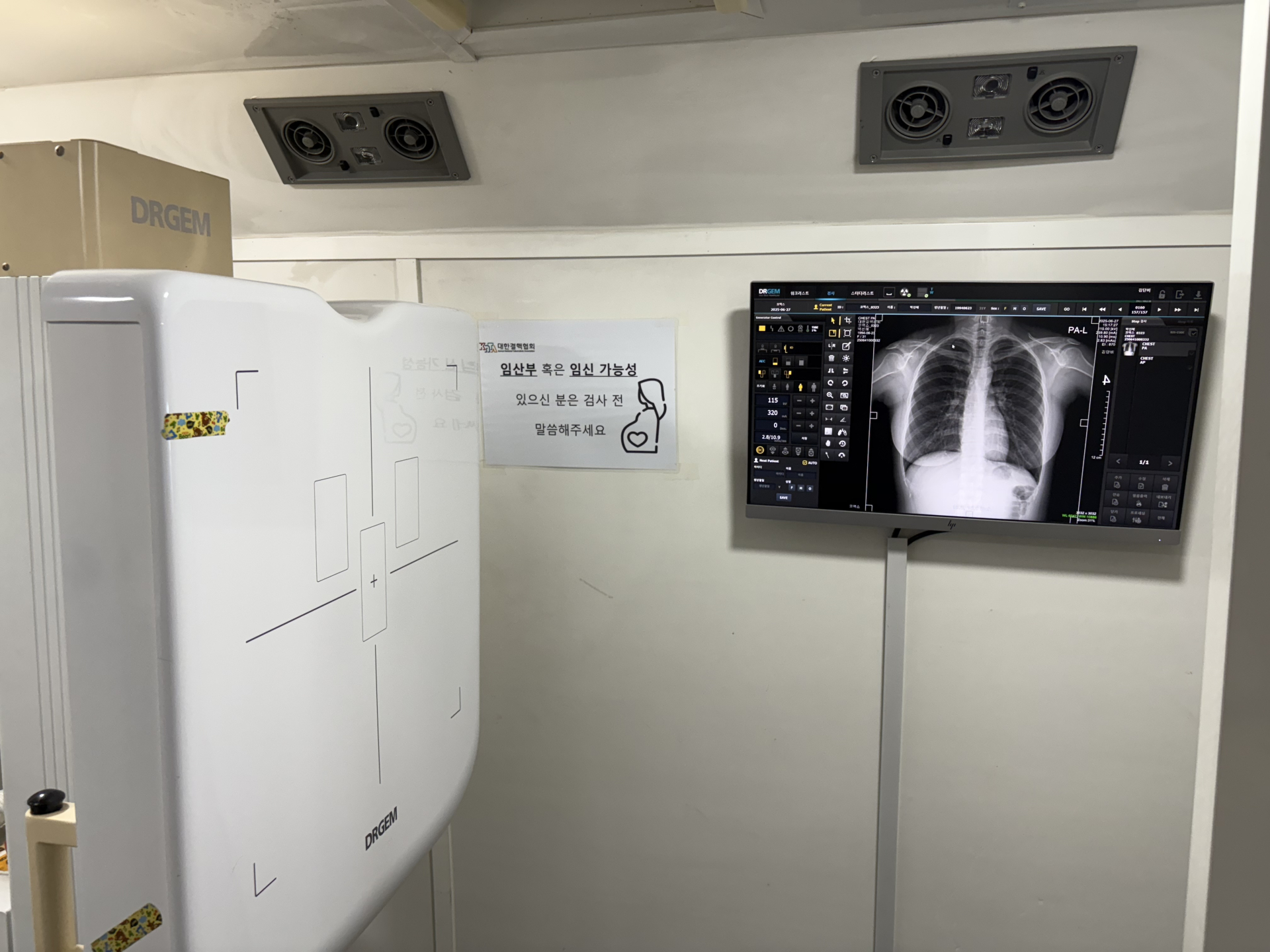 “5분이면 질환 유무 확인”…AI로 보는 나의 폐 상태